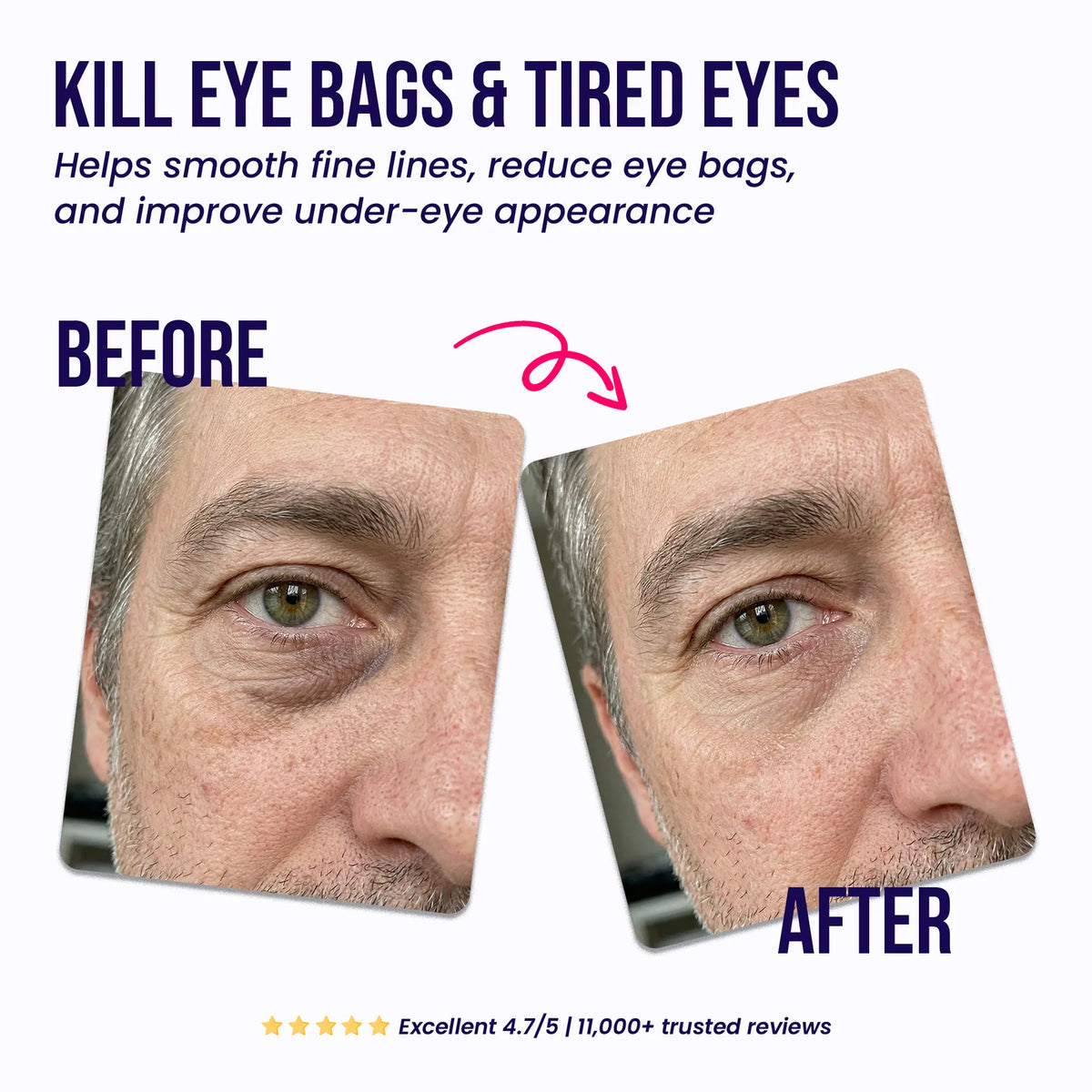 Under Eye Repair Patches